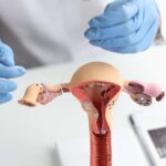 Examining Women's Sterilization Choices in Light of Changing Reproductive Policies